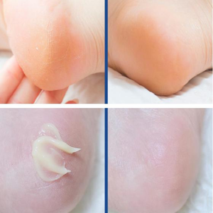 MEDI PEEL EGF Scaling Moisture Foot Cream 2.0, 130g