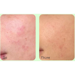 MEDI PEEL YOUNG CICA PDRN TROUBLE SOOTHING CREAM