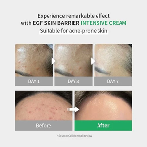 ZIPIDERM EGF Skin Barrier Intensive Cream 80ml