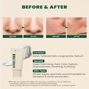 K-SECRET SEOUL 1988 Cleansing Foam :Pine Cica 1% +Probiotics 150ml