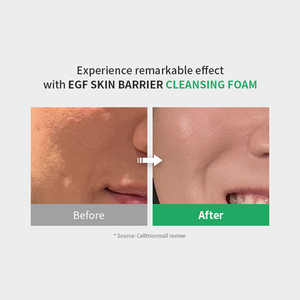 ZIPIDERM EGF Skin Barrier Cleansing Foam 120ml
