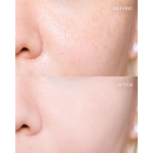 AXIS-Y PHA Resurfacing Glow Peel 50ml