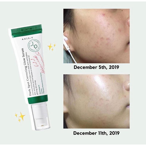 AXIS-Y Dark Spot Correcting Glow Serum 50ml