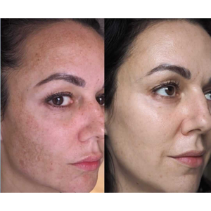 COS DE BAHA Hydroquinone 2% Serum 