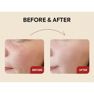 K-SECRET SEOUL 1988 Serum : Retinal Liposome 2% + Black 30ml