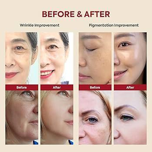 K-SECRET SEOUL 1988 Serum : Retinal Liposome 2% + Black 30ml