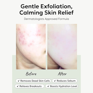 CELIMAX Ji Woo Gae Heartleaf BHA Peeling Pad 125ml / 60pads