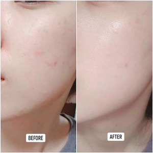 SKIN1004 Madagascar Centella Hyalu-Cica Brightening Toner 210ml